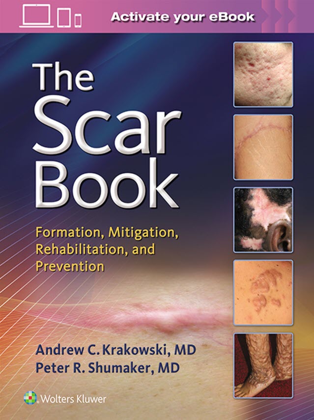 (eBook PDF)The Scar Book: Formation, Mitigation, Rehabilitation and Prevention - Original PDF by Dr. Andrew C. Krakowski , Dr. Peter R. Shumaker 