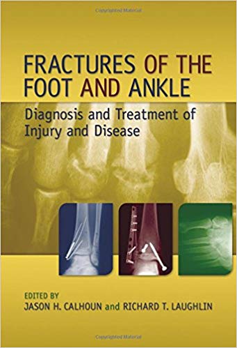 (eBook PDF)Fractures of Foot and Ankle by Jason H. Calhoun , Richard T. Laughlin 