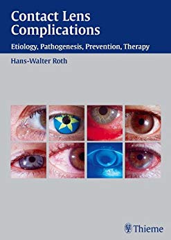 (eBook PDF)Contact Lens Complications, 1e  by Hans-Walter Roth 