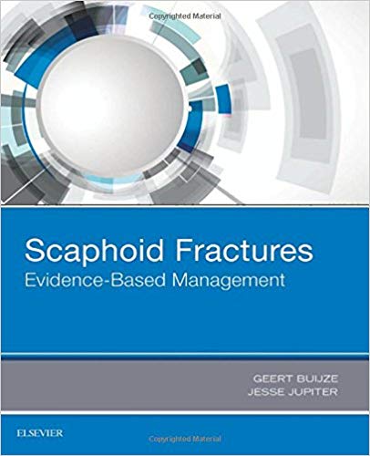 (eBook PDF)Scaphoid Fractures - Evidence-Based Management by Geert Buijze MD , Jesse B. Jupiter 