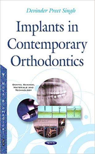 (eBook PDF)Implants in Contemporary Orthodontics by Devinder Preet Singh 