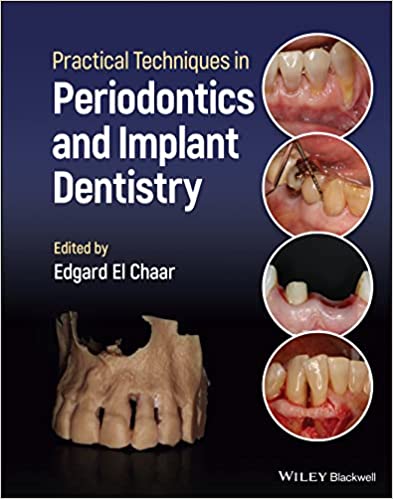 (eBook PDF)Practical Techniques in Periodontics and Implant Dentistry by Edgard El Chaar