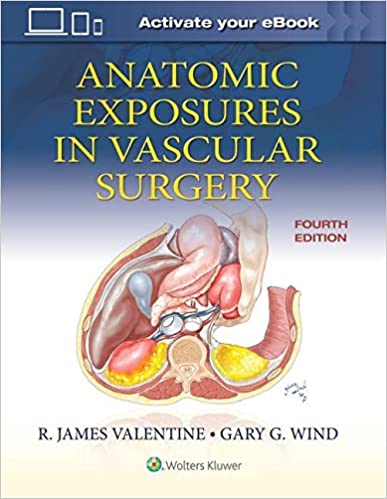 (ebook PDF)Anatomic Exposures in Vascular Surgery Fourth Edition by R. James Valentine MD FACS,Gary G. Wind MD