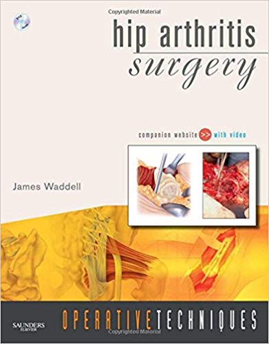 (eBook PDF)Operative Techniques Hip Arthritis Surgery by James P. Waddell 