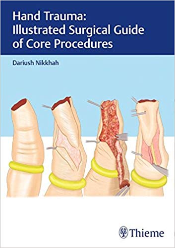 (eBook PDF)Hand Trauma - Illustrated Surgical Guide of Core Procedures by Dariush Nikkhah 