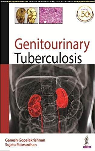 (eBook PDF)Genitourinary Tuberculosis by Ganesh Gopalakrishnan , Sujata Patwardhan 