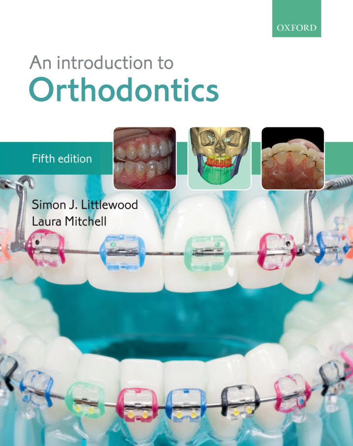 (eBook PDF)An Introduction to Orthodontics 5th Edition