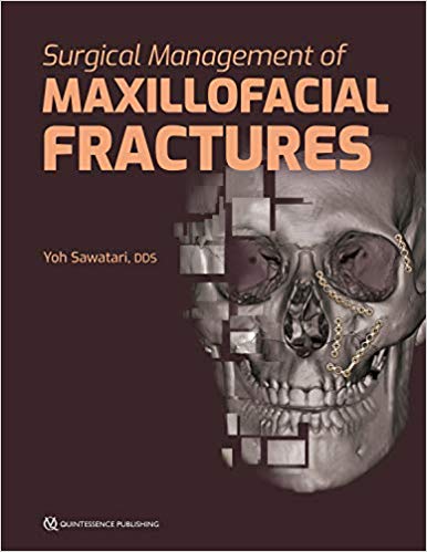 (eBook PDF)Surgical Management of Maxillofacial Fractures by Yoh Sawatari 