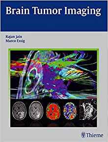 (eBook PDF)Brain Tumor Imaging by Rajan Jain , Marco Essig 