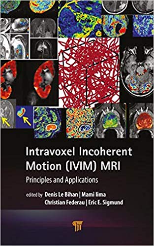 (eBook PDF)Intravoxel Incoherent Motion (IVIM) MRI by Denis Le Bihan , Mami Iima , Christian Federau , Eric E. Sigmund 