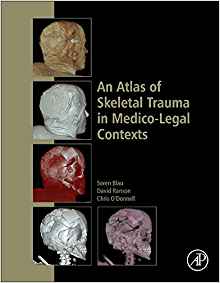 (eBook PDF)An Atlas of Skeletal Trauma in Medico-Legal Contexts by Soren Blau , David Ranson , Chris O'Donnell 