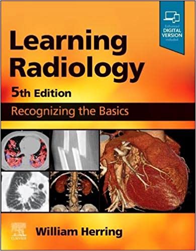 (eBook PDF)Learning Radiology: Recognizing the Basics 5th Edition by William Herring MD FACR 