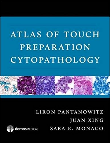 (eBook PDF)Atlas of Touch Preparation Cytopathology 1st Edition by Liron Pantanowitz MD , Juan Xing MD , Sara E. Monaco MD 