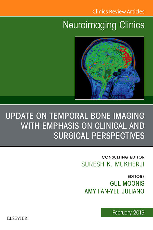 (eBook PDF)Update on Temporal Bone Imaging with Emphasis on Clinical and Surgical Perspectives by Gul Moonis , Amy Fan-Yee Juliano 