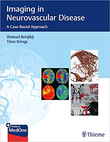 (eBook PDF)Imaging in Neurovascular Disease: A Case-Based Approach by Waleed Brinjikji , Timo Krings 