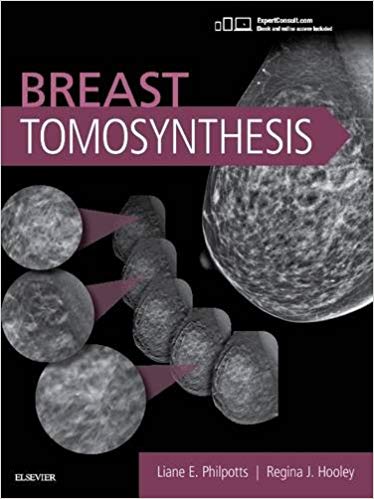 (eBook PDF)Breast Tomosynthesis, 1e 1st Edition by Liane E Philpotts MD FACR , Regina J Hooley MD 