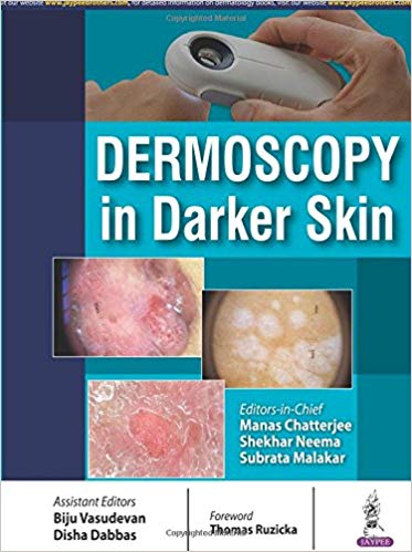 (eBook PDF)Dermoscopy in Darker Skin by Manas Chatterjee 