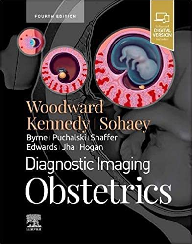 (eBook PDF)Diagnostic Imaging Obstetrics 4th Edition by Paula J. Woodward MD