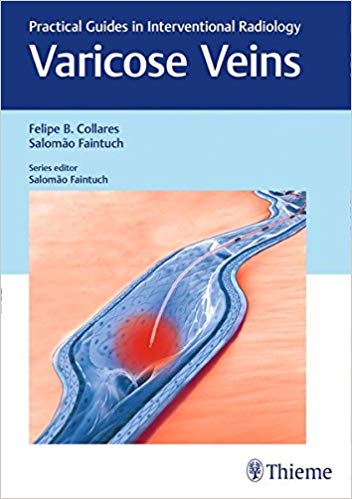 (eBook PDF)Varicose Veins: Practical Guides in Interventional Radiology by Felipe Collares , Salomao Faintuch 