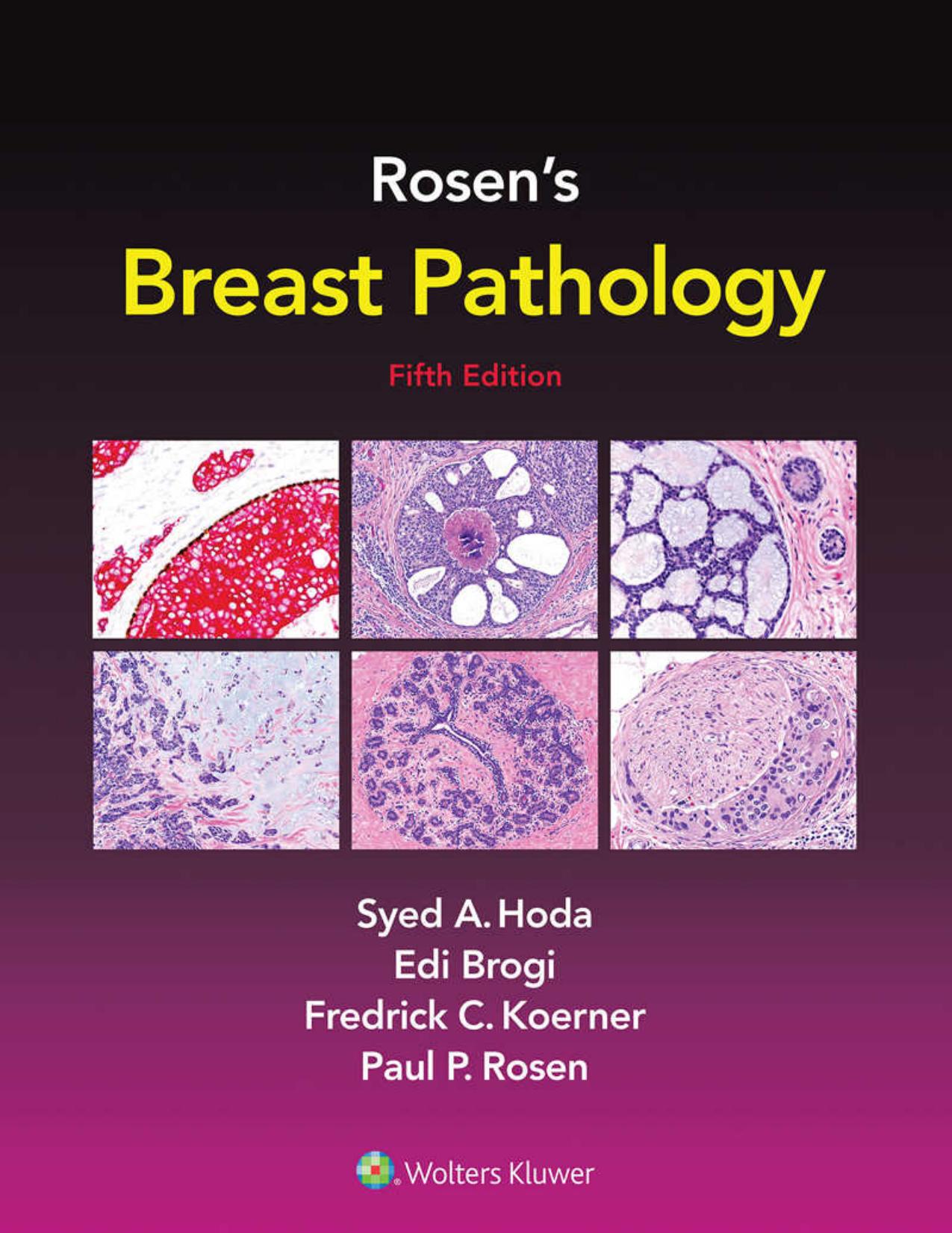 (eBook PDF)Rosen＆＃39;s Breast Pathology 5th Edition by Syed A. Hoda,Paul Peter Rosen