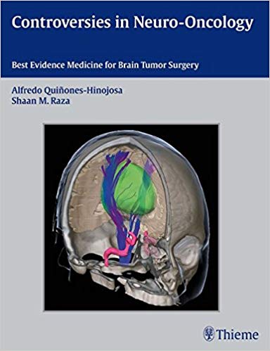 (eBook PDF)Controversies in Neuro-Oncology by Alfredo Quinones-Hinojosa , Shaan M. Raza , Edward R. Laws 