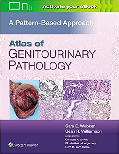 (eBook HTML)Atlas of Genitourinary Pathology A Pattern Based Approach by Sara E. Wobker MD MPH , Sean R. Williamson MD FASCP 