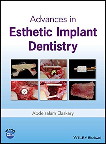 (eBook PDF)Advances in Esthetic Implant Dentistry by Abdelsalam Elaskary 