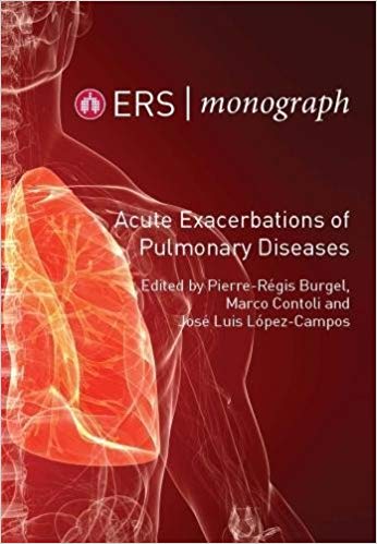 (eBook PDF)Acute Exacerbations of Pulmonary Diseases (ERS Monograph 77) by Pierre-Regis Burgel , Marco Contoli , Jose Luis Lopez-Campos 