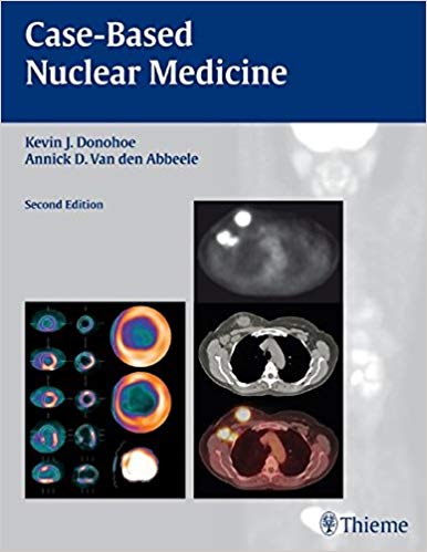 (eBook PDF)Case-based Nuclear Medicine by Kevin Donohoe , Annick Van den Abbeele , Kevin J. Donohoe , Annick D. Van den Abbeele 