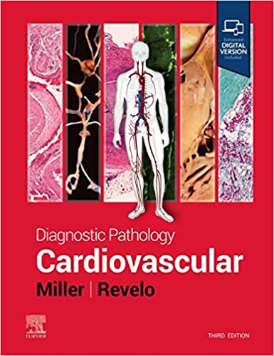 (eBook PDF)Diagnostic Pathology Cardiovascular 3rd Edition by Dylan V. Miller MD , Monica P. Revelo MD PhD 