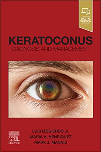 (eBook PDF)Keratoconus: Diagnosis and Management 1st Edition by Luis Izquierdo,Maria Henriquez,Mark J. Mannis