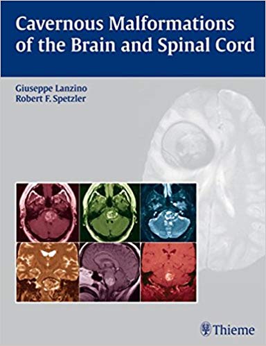 (eBook PDF)Cavernous Malformations of the Brain and Spinal Cord by Giuseppe Lanzino , Robert F. Spetzler 