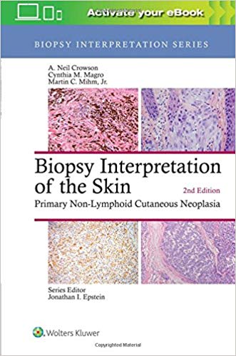 (eBook PDF)Biopsy Interpretation of the Skin - Primary Non-Lymphoid Cutaneous Neoplasia (Biopsy Interpretation Series) Second Ed... by A. Neil Crowson MD , Cynthia M. Magro MD 
