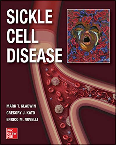 (eBook PDF)Sickle Cell Disease by Mark T. Gladwin , Gregory J. Kato , Enrico M. Novelli 