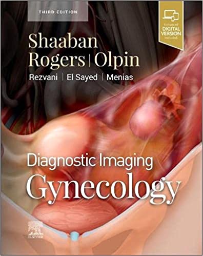(eBook PDF)Diagnostic Imaging Gynecology 3rd Edition - E-Book by Akram M Shaaban MBBCh , Douglas Rogers MD 
