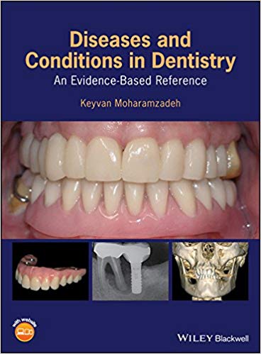 (eBook PDF)Diseases and Conditions in Dentistry by Keyvan Moharamzadeh 