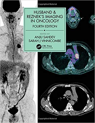 (eBook PDF)Husband and Rezneks Imaging in Oncology 4th Edition by Anju Sahdev , Sarah J. Vinnicombe 