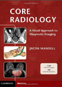 (eBook PDF) Core Radiology A Visual Approach to Diagnostic Imaging