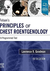 (eBook PDF)Felsons Principles of Chest Roentgenology E-Book: A Programmed Text 5th Edition by Lawrence R. Goodman  