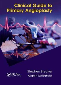 (eBook PDF)Clinical Guide to Primary Angioplasty 1st Edition by Stephen Brecker , Martin Rothman  