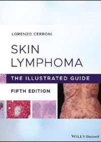 (eBook PDF)Skin Lymphoma: The Illustrated Guide 5th Edition by Lorenzo Cerroni   