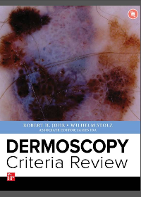 (eBook PDF)Dermoscopy Criteria Review by Robert Johr, Wilhelm Stolz