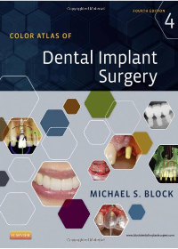 (eBook PDF)Color Atlas of Dental Implant Surgery, 4th Edition by Michael S. Block DMD  Saunders; 4 edition (July 25, 2014)