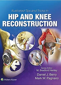 (eBook PDF)Illustrated Tips and Tricks in Hip and Knee Reconstructive and Replacement Surgery by Daniel J. Berry , Mark W. Pagnano  Lippincott Williams and Wilkins; 1 edition (25 Oct. 2019)