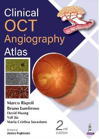 (eBook PDF)Clinical OCT Angiography Atlas 2nd Edition by Marco Rispoli, Bruno Lumbroso