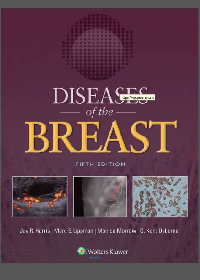 (eBook PDF) Diseases of the Breast 5th Edition
