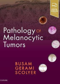 (eBook PDF)Pathology of Melanocytic Tumors E-Book 1st Edition by Klaus J. Busam , Richard A Scolyer , Pedram Gerami 