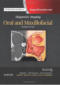 (eBook PDF)Diagnostic Imaging: Oral and Maxillofacial 2nd Edition by Lisa J. Koenig BChD DDS MS , Dania Tamimi BDS DMSc , C Grace Petrikowski DDS MSc FRCD(C) , Susanne E. Perschbacher DDS MSc FRCD(C) 