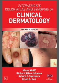 (eBook PDF)Fitzpatrick’s Color Atlas and Synopsis of Clinical Dermatology 8th Edition by Klaus Wolff et al.