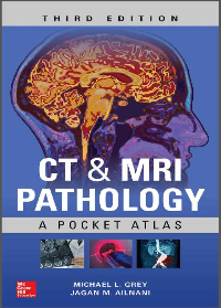 (eBook PDF)CT & MRI Pathology: A Pocket Atlas Third Edition by Michael L Grey, Jagan Mohan Ailinani